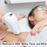 Laser Hair Removal