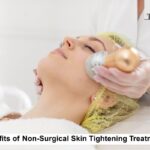 Benefits of Non-Surgical Skin Tightening Treatments