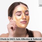 Chemical Peels