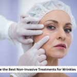 Wrinkle Treatments
