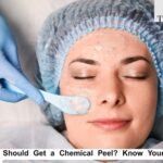 Chemical Peels