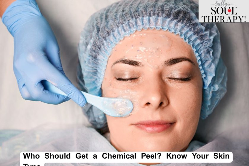 Chemical Peels