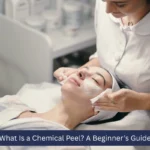 chemical peels