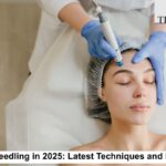 Microneedling