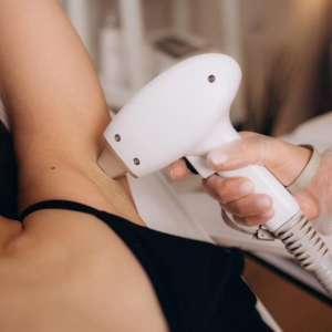 laser hair removal
