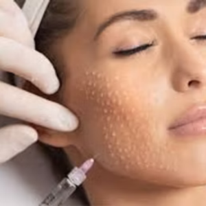 Other Treatments mizo therapy