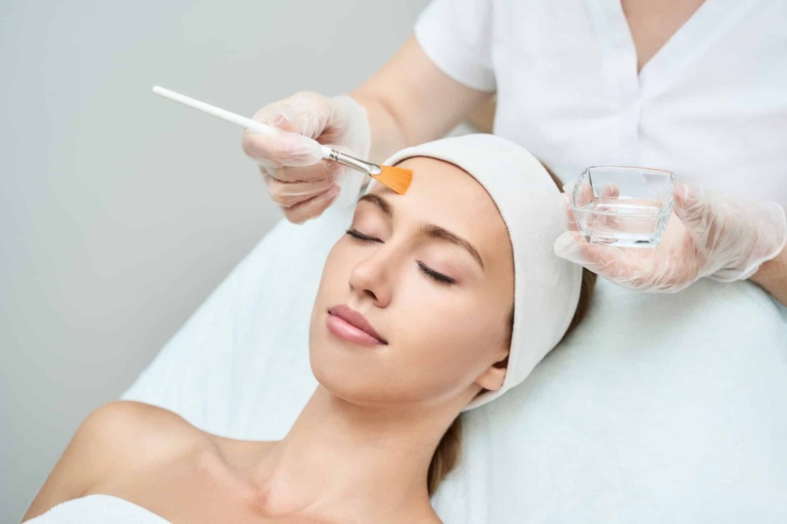 chemical peels in 2025