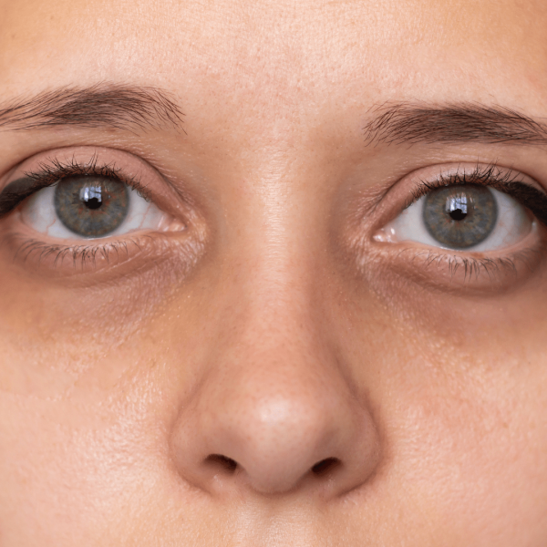 Home dark circles qvy6rg72bwyorjxdnk46ers26qvnf884dok94axn5c.png