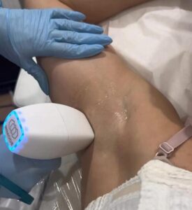 Other Treatments pits treatments