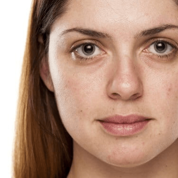 Home dull and tired skin qvy6rrh4lxe4mvgztozp8oxlbdc1zlgwf8e2vmgx2o.png