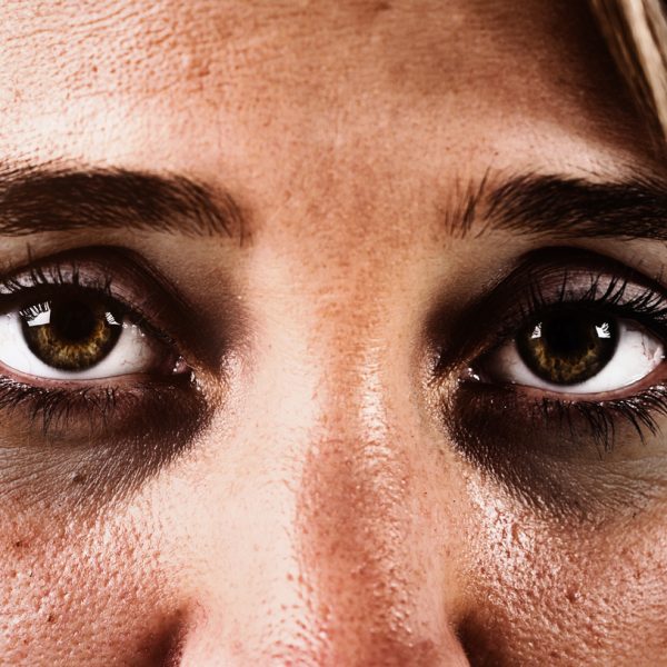 Cropped close up of a woman's sad, exhausted brown eyes, ringed with dark circles and looking straight at the camera.