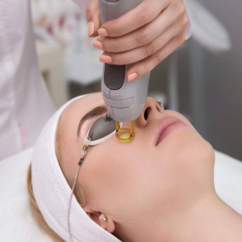 laser treatment